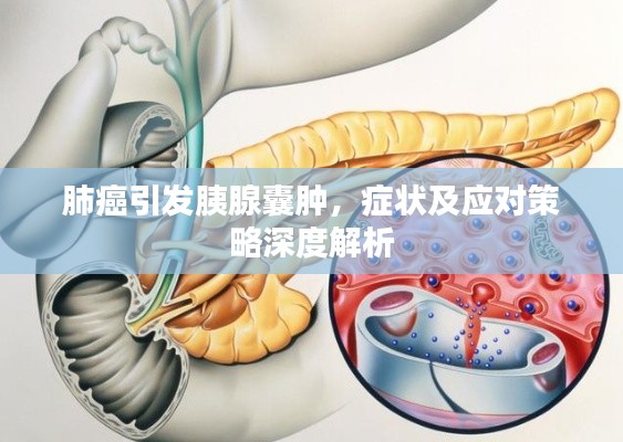 肺癌引發(fā)胰腺囊腫，癥狀及應(yīng)對(duì)策略深度解析