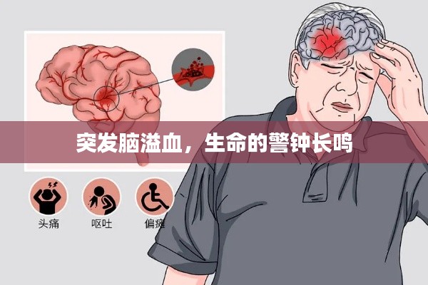 突發腦溢血，生命的警鐘長鳴