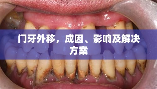門牙外移，成因、影響及解決方案