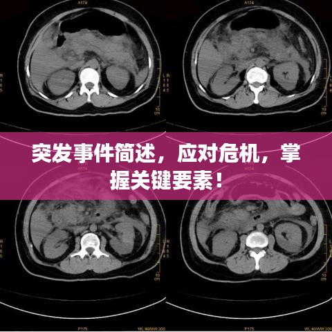突發(fā)事件簡述，應(yīng)對危機，掌握關(guān)鍵要素！
