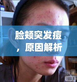臉頰突發(fā)痘，原因解析、預(yù)防策略及應(yīng)對(duì)妙招