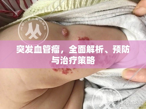 突發血管瘤，全面解析、預防與治療策略